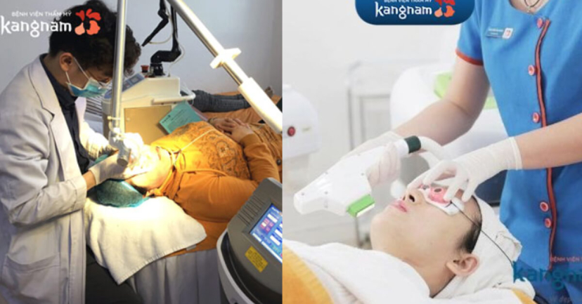 Điều trị bằng laser tại bệnh viện Gangnam